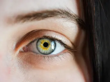 Ojo Ojo