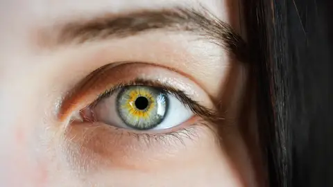 Ojo Ojo