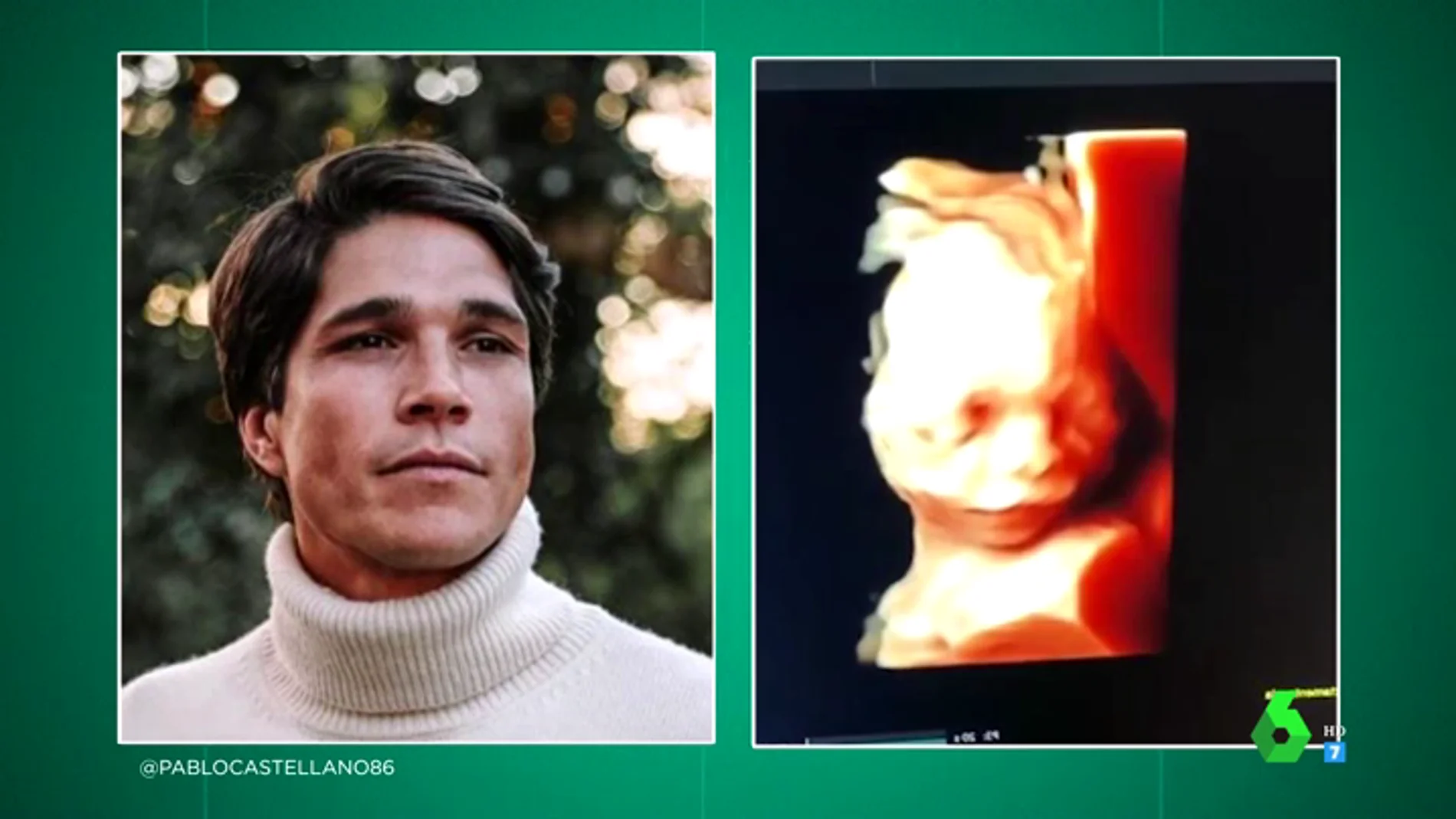 María Pombo comparte en Instagram la primera ecografía en 3D de su bebé