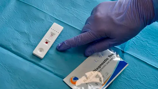 Test del coronavirus Test del coronavirus