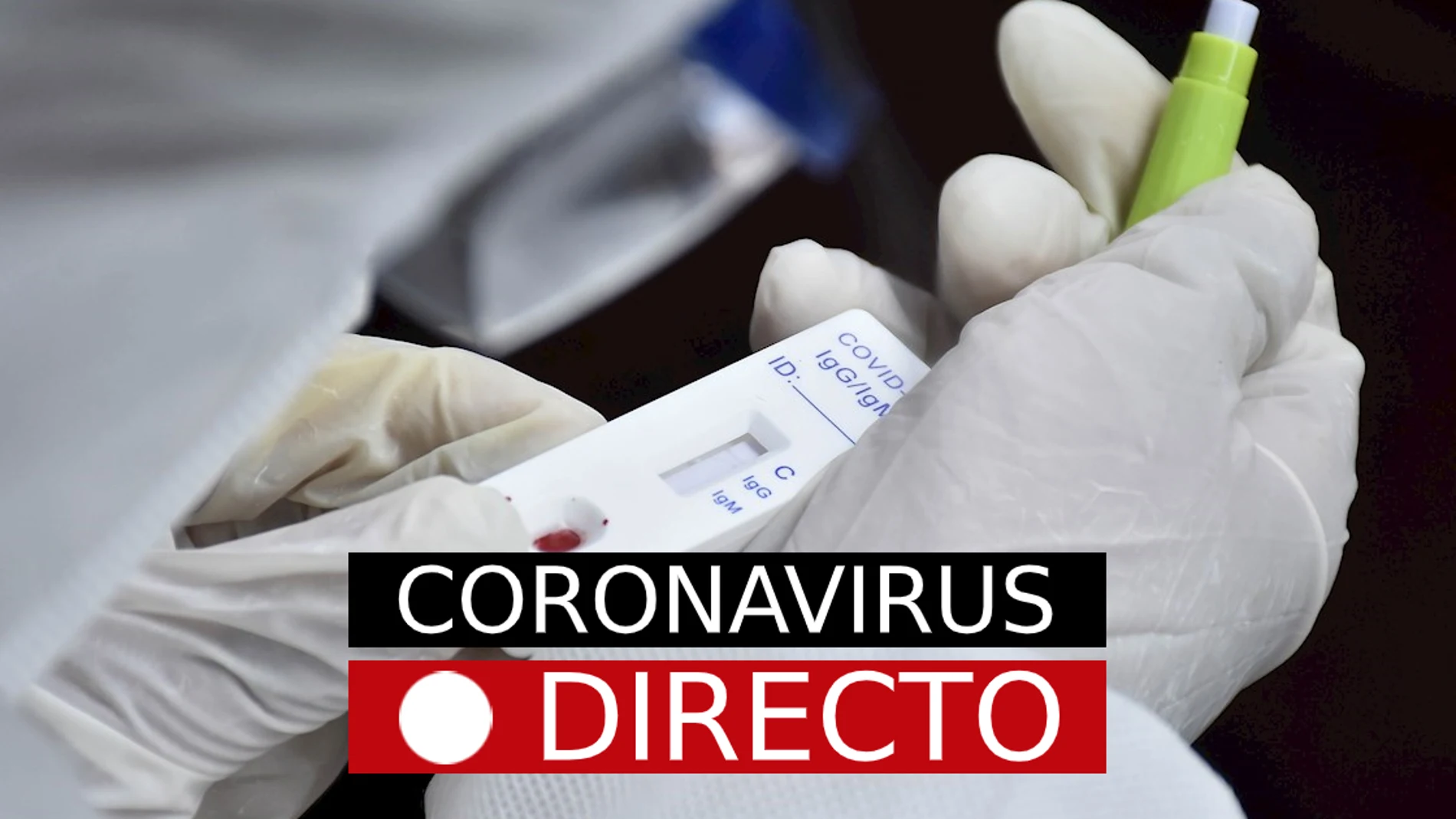 Imagen de un test de coronavirus