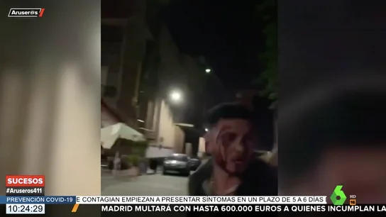 Omar Montes, ensangrentado tras una pelea Omar Montes, ensangrentado tras una pelea