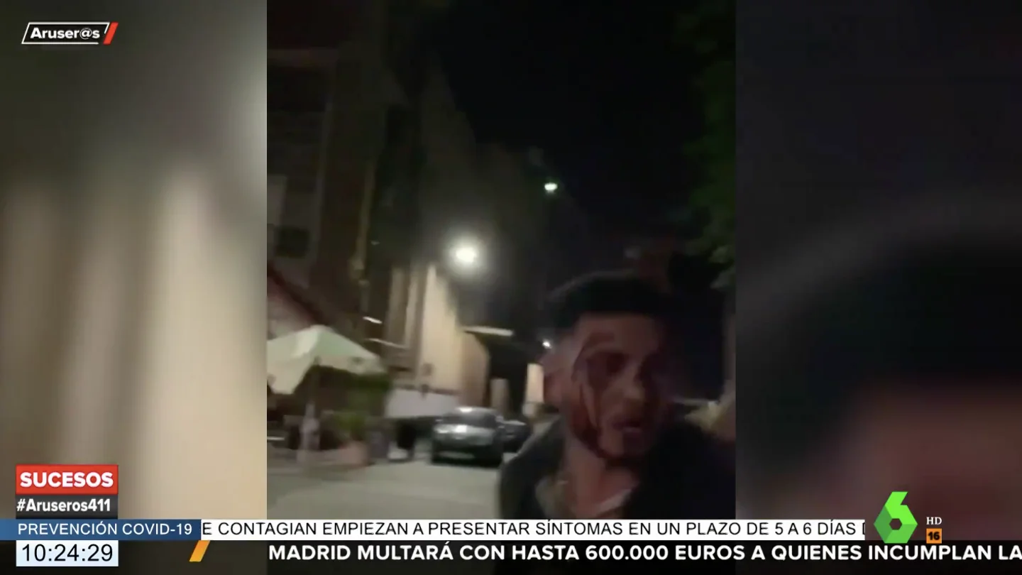 Omar Montes, ensangrentado tras una pelea Omar Montes, ensangrentado tras una pelea