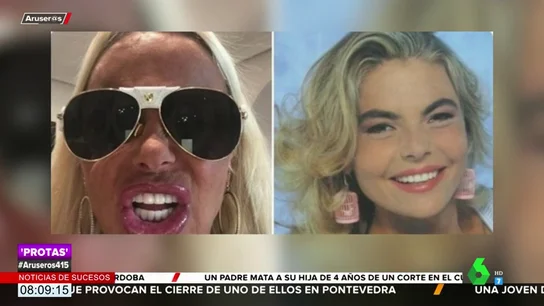 El retoque estético de Leticia Sabater con el que recupera su sonrisa de hace 25 años por 4.000 euros El retoque estético de Leticia Sabater con el que recupera su sonrisa de hace 25 años por 4.000 euros