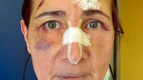 Stefania Buonpensiero, la mujer agredida Stefania Buonpensiero, la mujer agredida