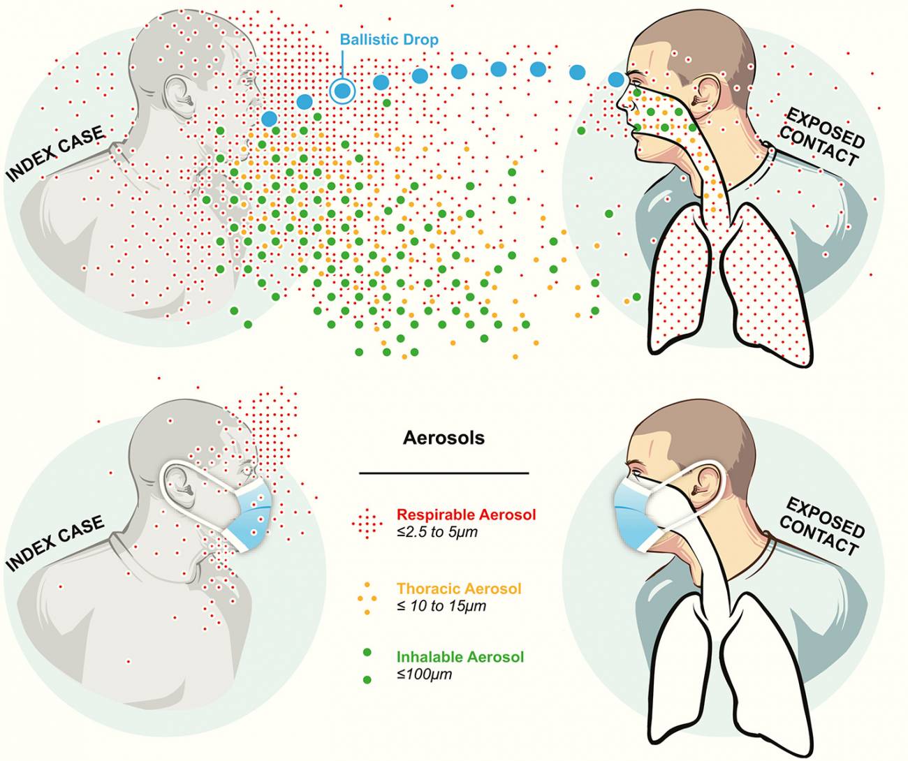 Representación esquemática de las vías de infección por gotitas balísticas (azul) y aerosol (verde, amarillo y rojo) para una enfermedad respiratoria. Ambos viajan a través del aire desde la persona infectada hasta la persona susceptible, pero las gotitas balísticas infectan por impacto y los aerosoles por inhalación. Se muestran dos situaciones sin y con el uso de mascarilla.
