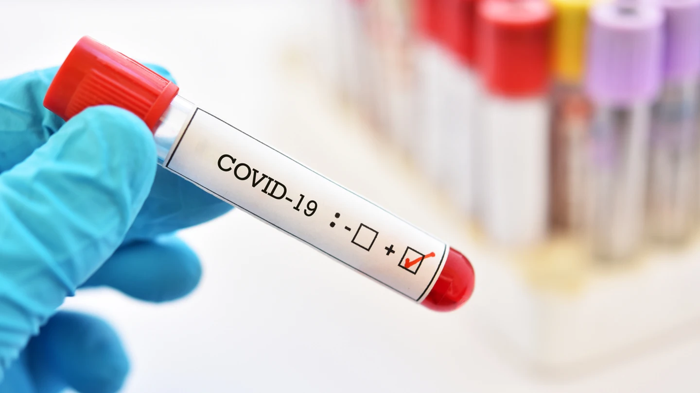 Covid-19. Covid-19.