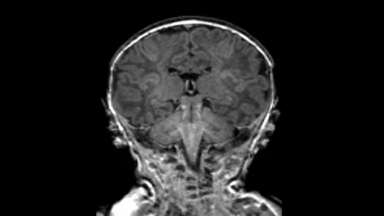 Así es el estudio pionero en el mundo que muestra cómo la contaminación afecta al cerebro del feto de una mujer embarazada Así es el estudio pionero en el mundo que muestra cómo la contaminación afecta al cerebro del feto de una mujer embarazada