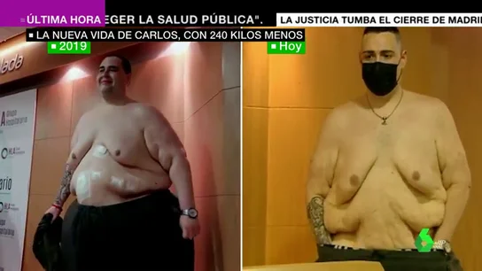 250 kilos menos 250 kilos menos