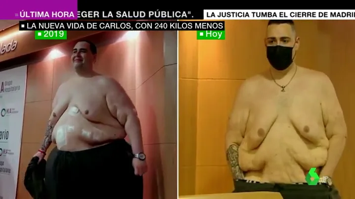 250 kilos menos