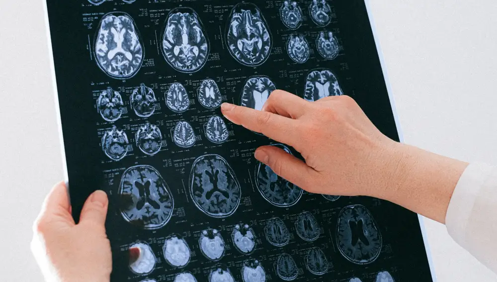 Radiografía cerebro