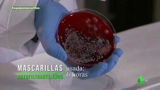 Cuida bien tu mascarilla contra otro 'problema invisible': el coronavirus no es lo único que puede hacerte daño Cuida bien tu mascarilla contra otro 'problema invisible': el coronavirus no es lo único que puede hacerte daño