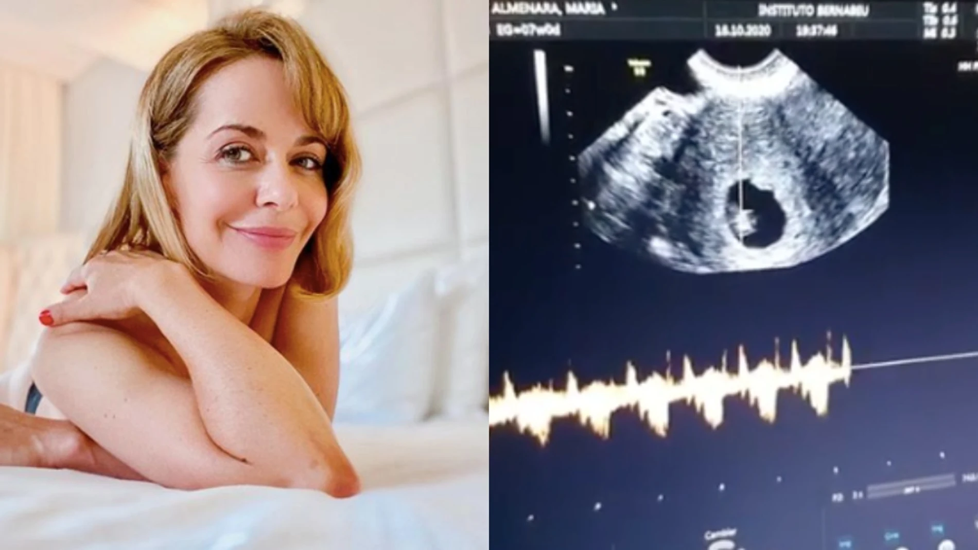 María Adánez anuncia que está embarazada de ocho semanas a sus 44 años