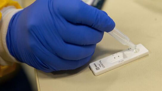 Test de anticuerpos del coronavirus