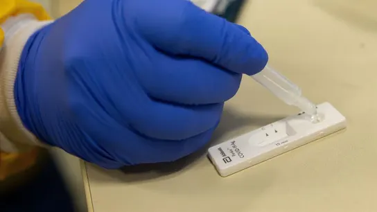 Test de anticuerpos del coronavirus Test de anticuerpos del coronavirus