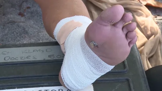 La aparatosa caída de Rocío que la deja impedida al menos una semana: "Tiene un esguince en el ligamento interno" La aparatosa caída de Rocío que la deja impedida al menos una semana: "Tiene un esguince en el ligamento interno"