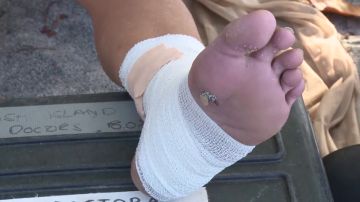 La aparatosa caída de Rocío que la deja impedida al menos una semana: "Tiene un esguince en el ligamento interno"