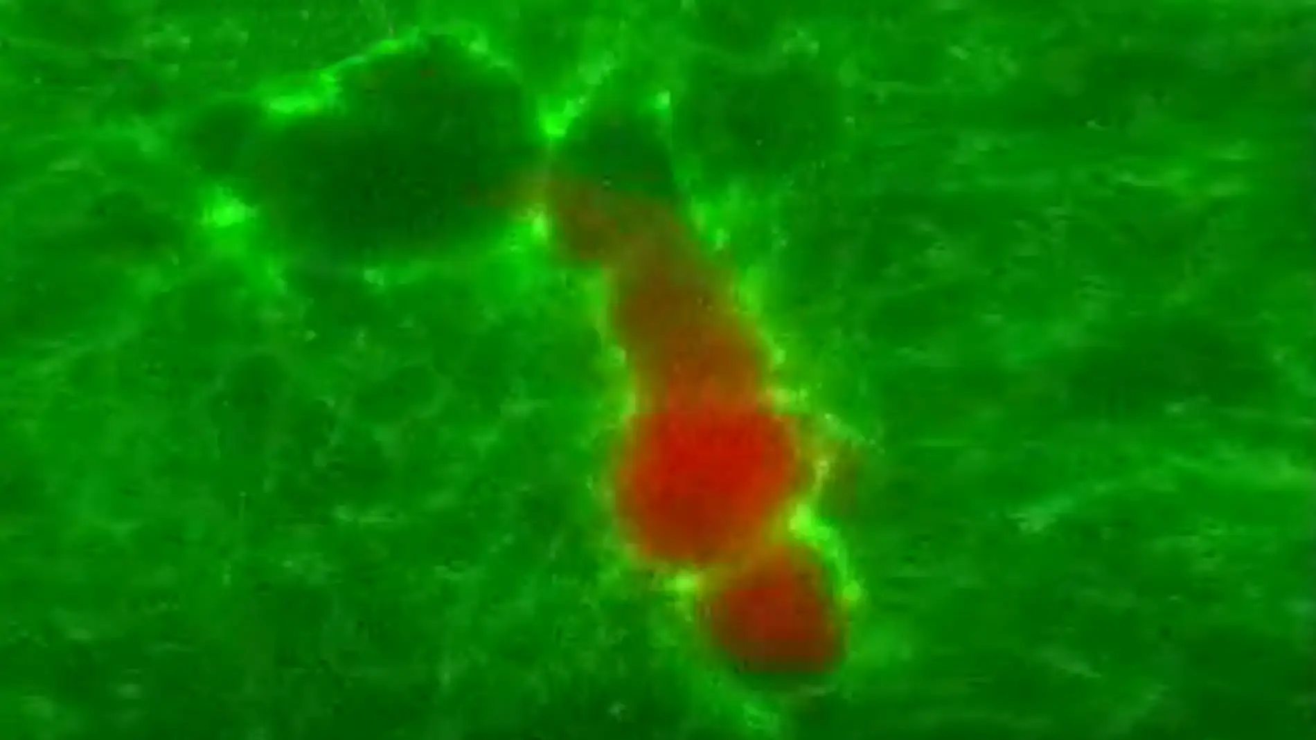 Estas celulas inmunitarias excavan tuneles en los tejidos