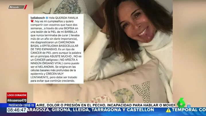 Lydia Bosch habla por primera vez tras anunciar que padece cáncer de piel