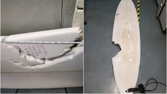 Mordedura de 17 pulgadas tras un ataque de tiburón en Hawáii Mordedura de 17 pulgadas tras un ataque de tiburón en Hawáii