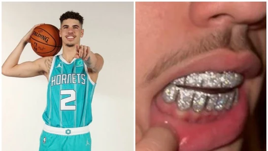 LaMelo Ball se pone una dentadura de oro blanco y diamantes LaMelo Ball se pone una dentadura de oro blanco y diamantes