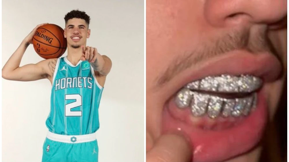 LaMelo Ball se pone una dentadura de oro blanco y diamantes