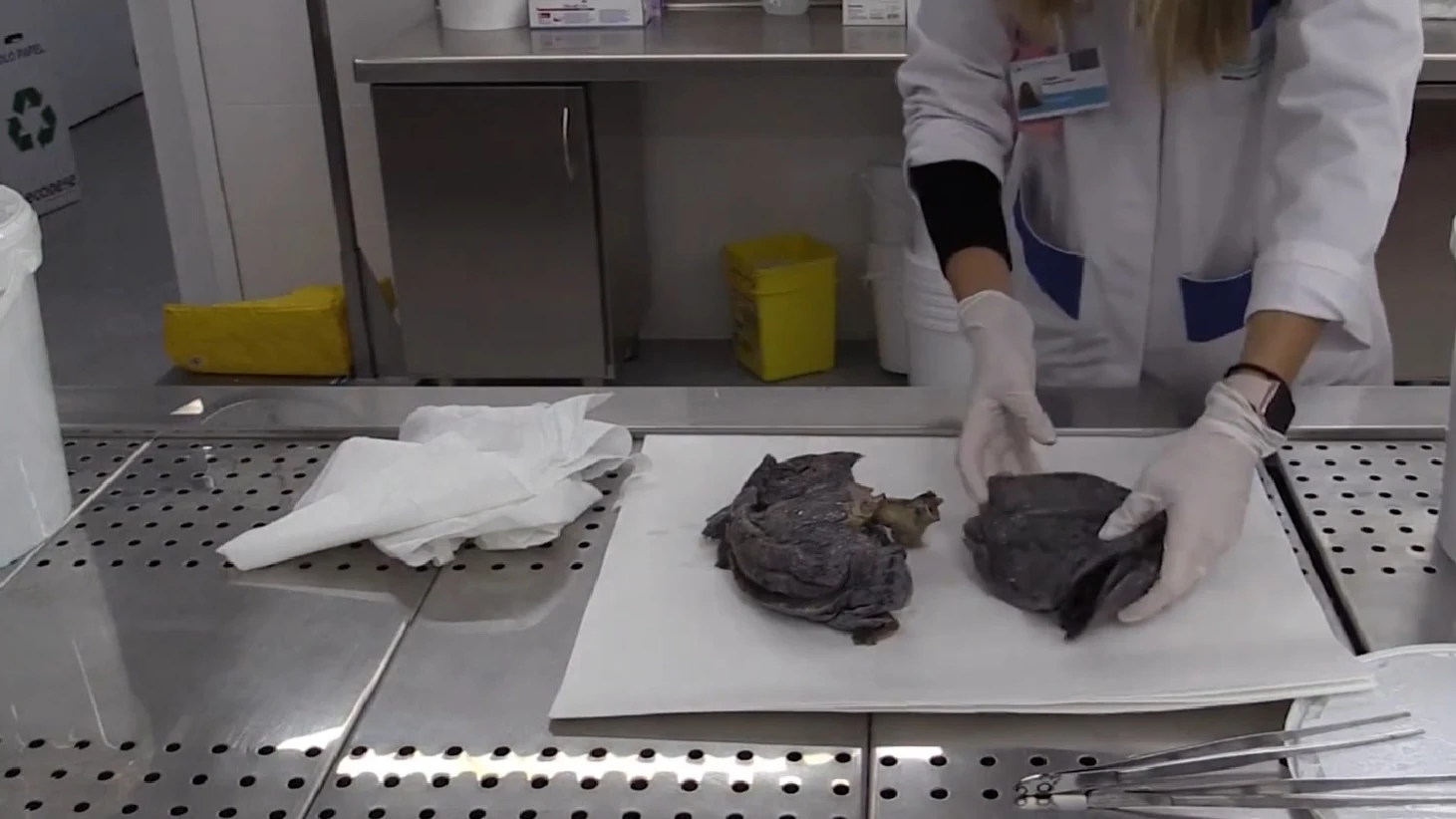 Imagen del laboratorio de la Fundación Jiménez Díaz donde se practican autopsias. Imagen del laboratorio de la Fundación Jiménez Díaz donde se practican autopsias.