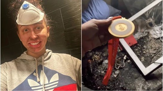 Daria Shkurikhina tras el incendio Daria Shkurikhina tras el incendio