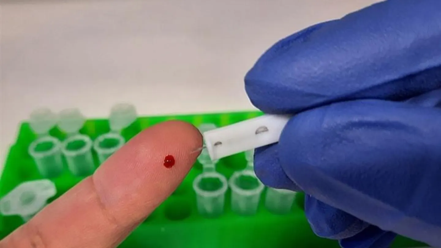 Un nuevo test permite detectar anticuerpos de COVID-19 empleando células cultivadas. Un nuevo test permite detectar anticuerpos de COVID-19 empleando células cultivadas.