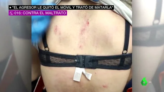 Buscan al agresor de una chica de 16 años en Málaga: le rompió dos vértebras porque quería romper la relación Buscan al agresor de una chica de 16 años en Málaga: le rompió dos vértebras porque quería romper la relación