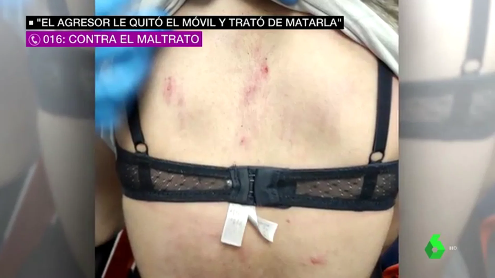 Buscan al agresor de una chica de 16 años en Málaga: le rompió dos vértebras porque quería romper la relación