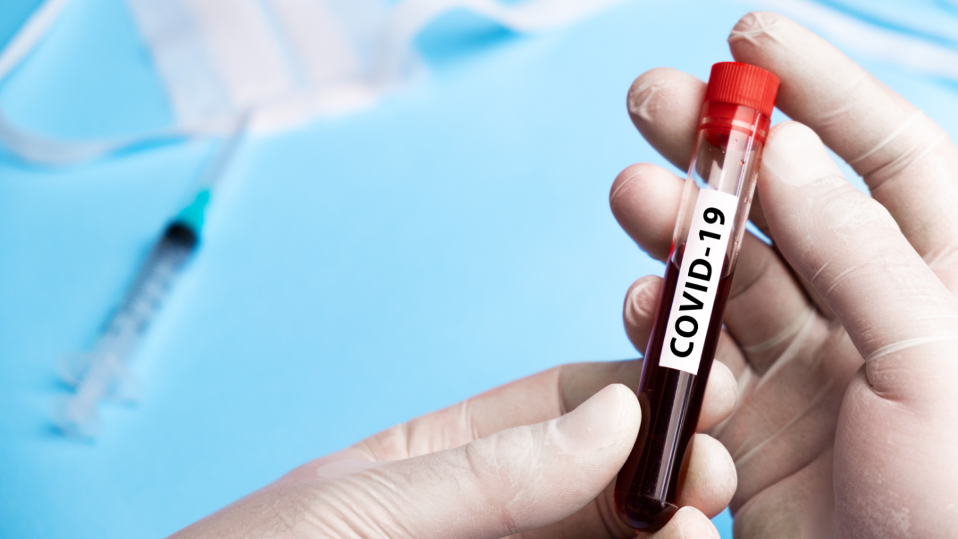 muestra de sangre para corona