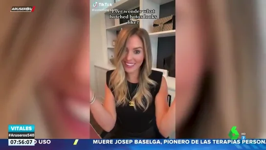 Una influencer muestra cómo ha quedado su cara tras una negligencia con el bótox Una influencer muestra cómo ha quedado su cara tras una negligencia con el bótox
