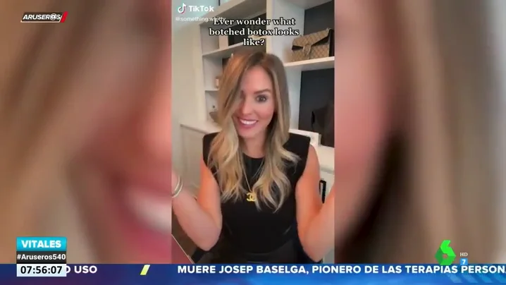 Una influencer muestra cómo ha quedado su cara tras una negligencia con el bótox