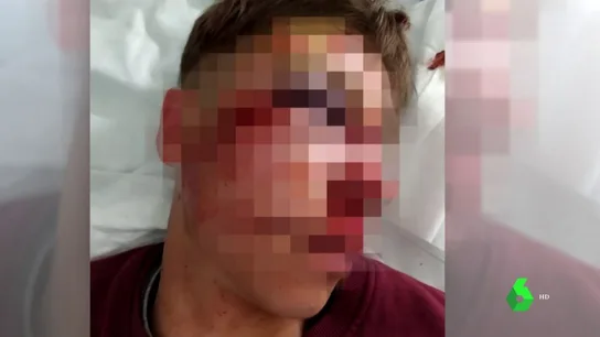 El menor agredido en Parla El menor agredido en Parla