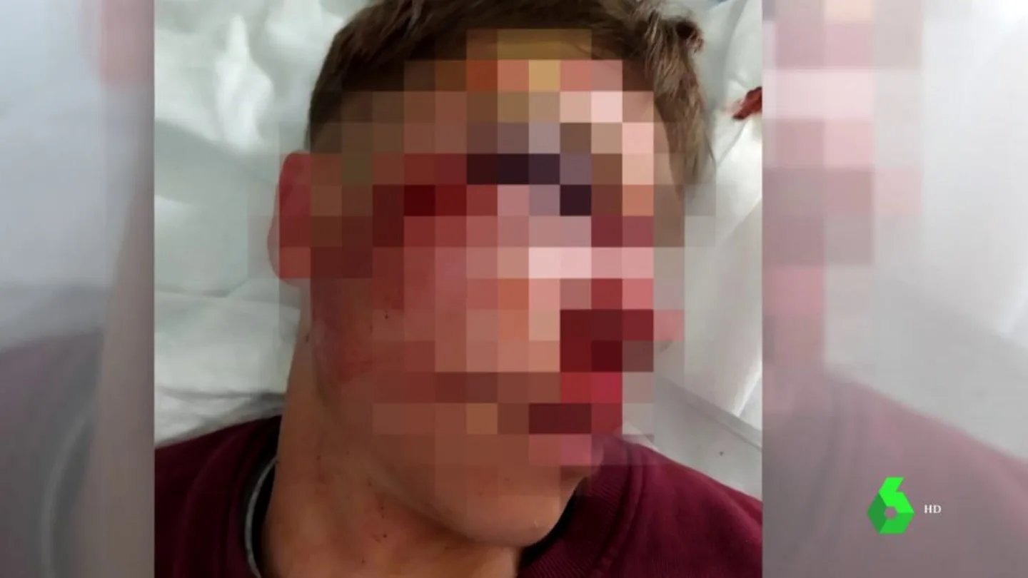 El menor agredido en Parla El menor agredido en Parla