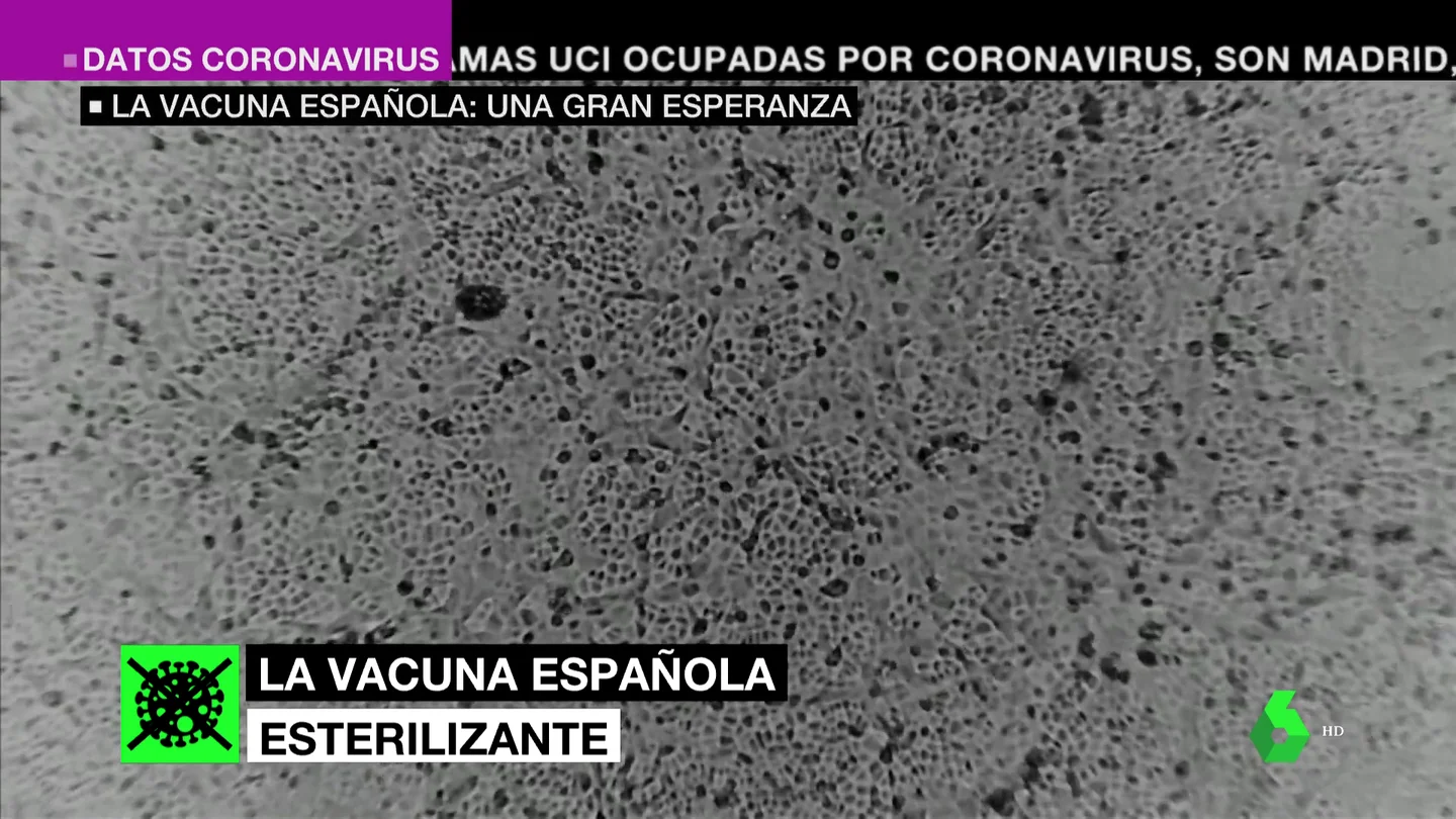 Barata, intranasal y 100%: así puede ser la vacuna española, la gran esperanza contra el coronavirus Barata, intranasal y 100%: así puede ser la vacuna española, la gran esperanza contra el coronavirus
