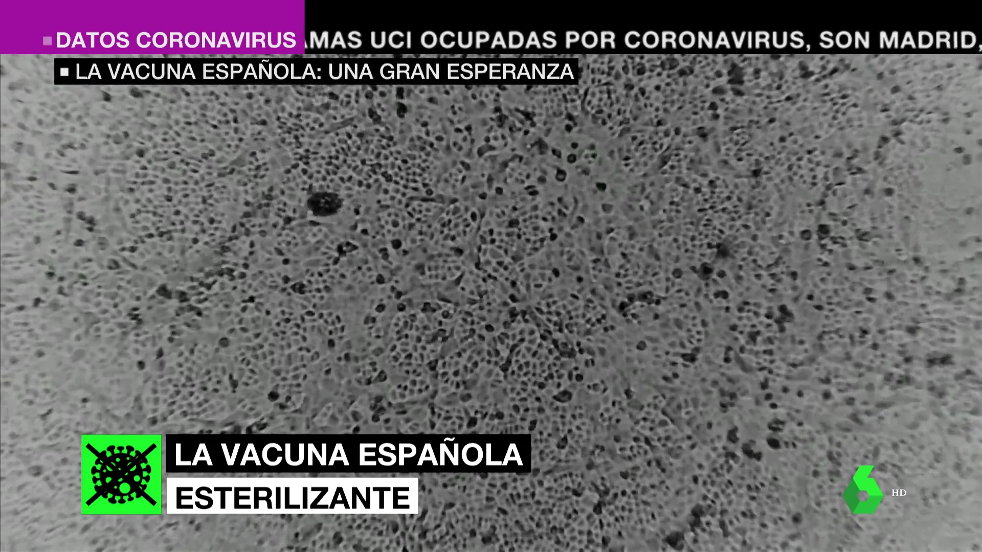 Barata, intranasal y 100%: así puede ser la vacuna española, la gran esperanza contra el coronavirus