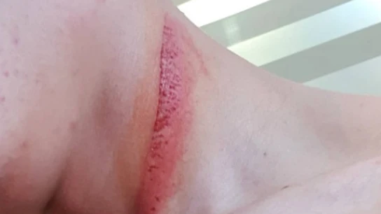Secuelas de Deniz Oncü, piloto de Moto3: "Tengo suerte de estar vivo" Secuelas de Deniz Oncü, piloto de Moto3: "Tengo suerte de estar vivo"