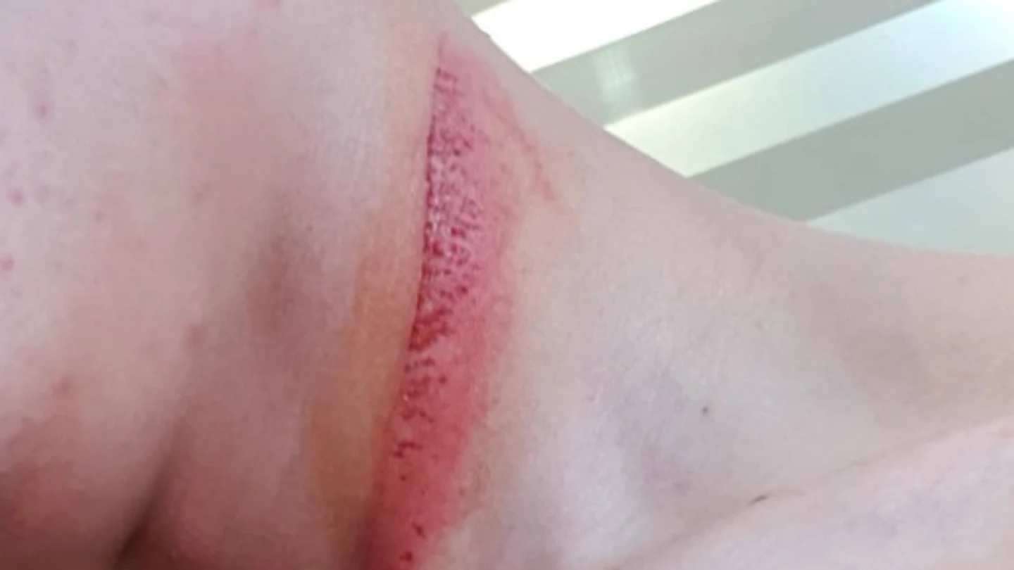 Secuelas de Deniz Oncü, piloto de Moto3: "Tengo suerte de estar vivo" Secuelas de Deniz Oncü, piloto de Moto3: "Tengo suerte de estar vivo"