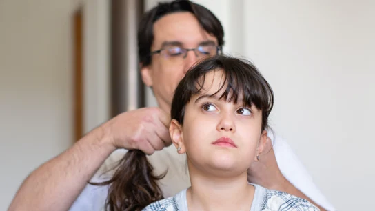 Cómo eliminar los piojos: ¿de verdad sirve el vinagre y otros remedios caseros?  Cómo eliminar los piojos: ¿de verdad sirve el vinagre y otros remedios caseros?