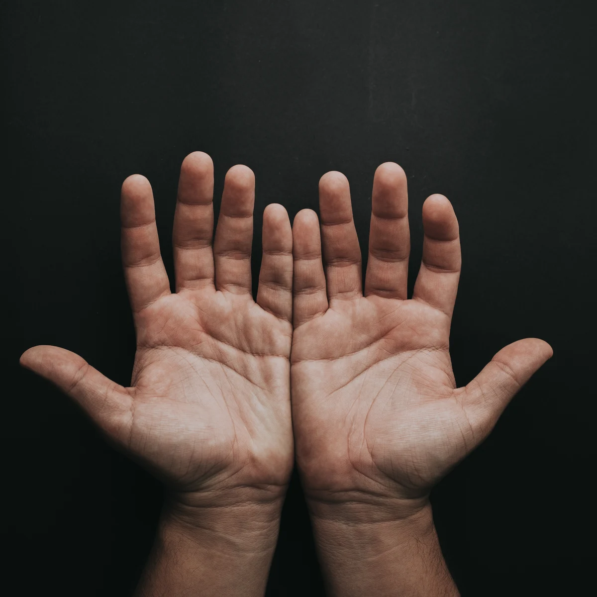 Registro Sin lugar a dudas Mala fe Por qué se quedan las manos dormidas? Las causas más frecuentes de esta  molestia