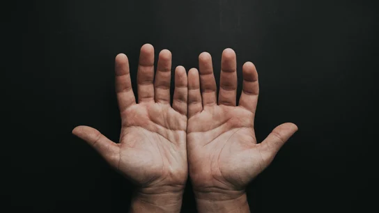 ¿Por qué se me duermen las manos? Las causas más frecuentes de esta molestia ¿Por qué se me duermen las manos? Las causas más frecuentes de esta molestia