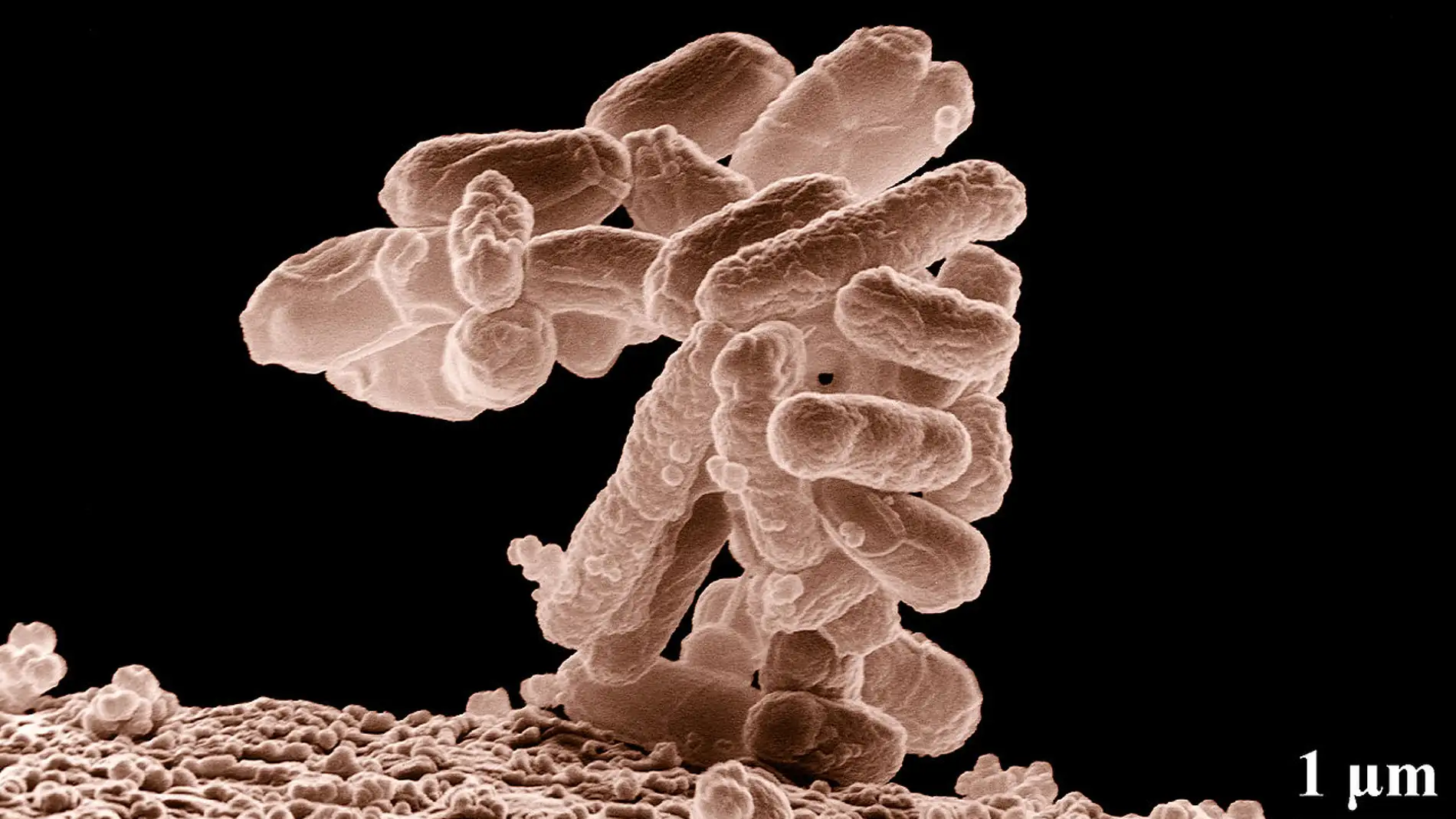 Micrografía electrónica de un cúmulo de bacterias E. coli ampliado cien mil veces