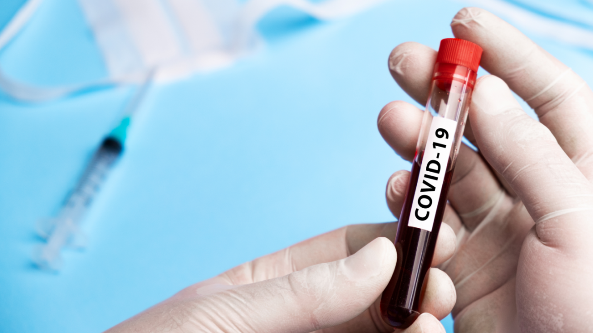 Muestra de sangre en un tubo