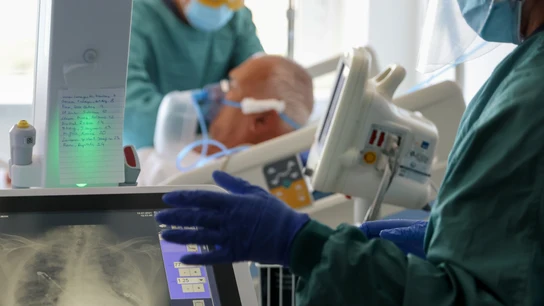 El Hospital del Mar de Barcelona trata a un paciente con problemas de pulmón El Hospital del Mar de Barcelona trata a un paciente con problemas de pulmón