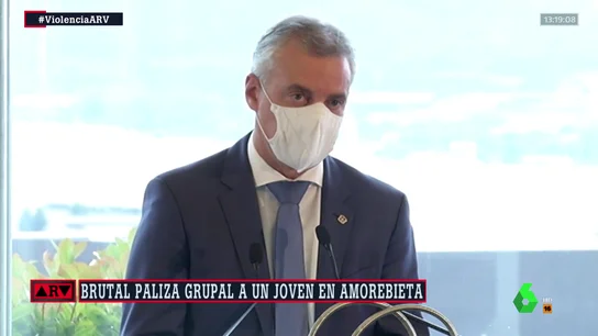 Urkullu condena la agresión a un joven en Amorebieta: "Sobrepasa cualquier límite" Urkullu condena la agresión a un joven en Amorebieta: "Sobrepasa cualquier límite"