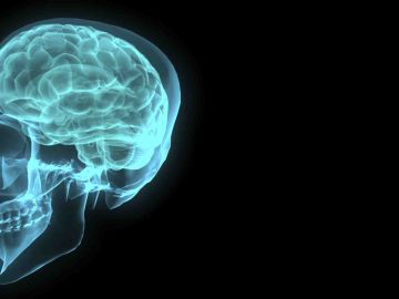 Recreación artística de un cerebro humano contenido en el cráneo