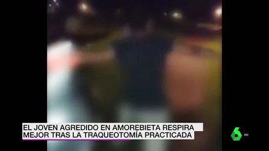 joven Amorebieta joven Amorebieta