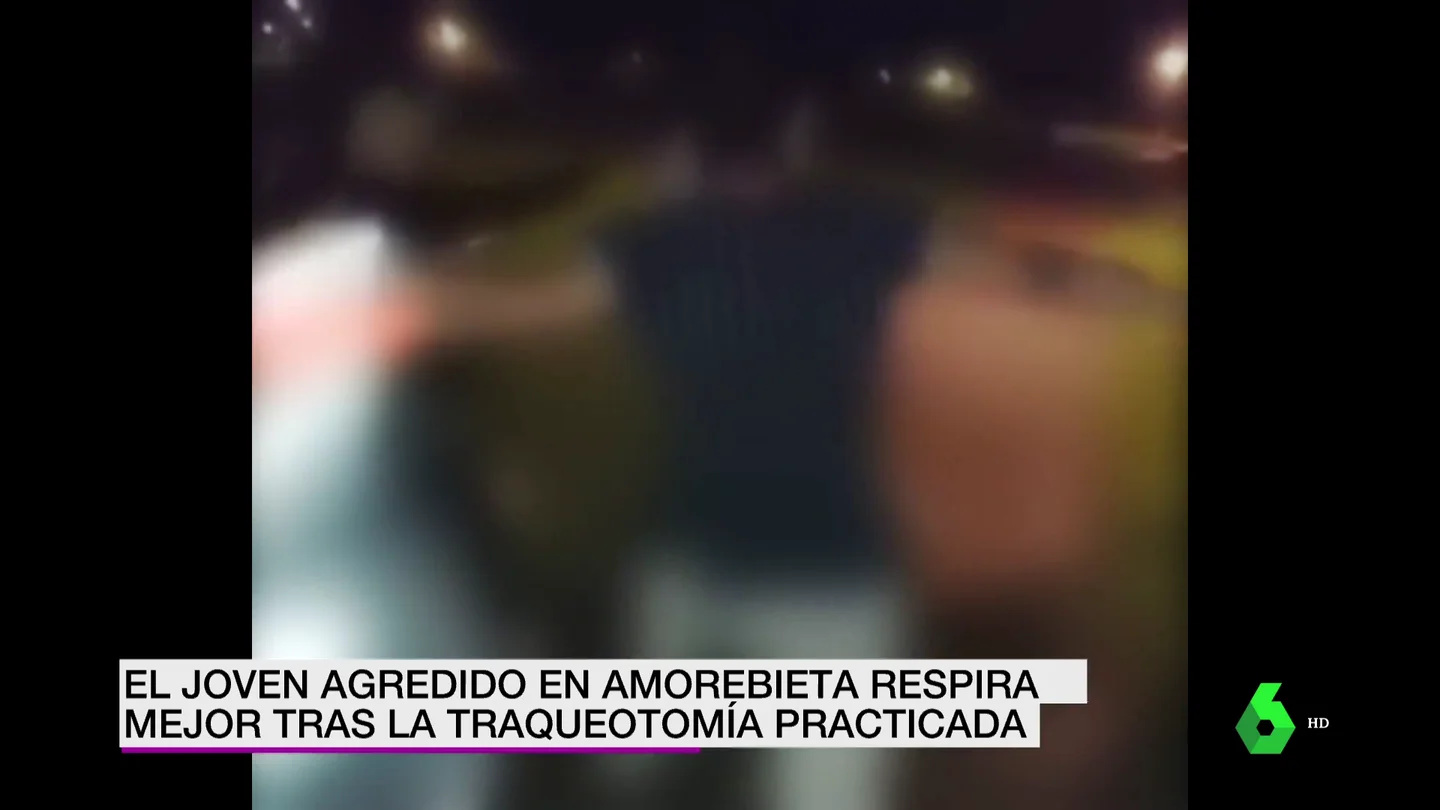 joven Amorebieta joven Amorebieta